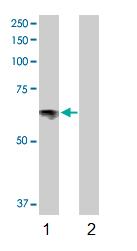 All lanes : Anti-Serotonin transporter antibody (ab102048) at 1/500 dilutionLane 1 : Serotonin transporter transfected lysate from 293T cell lineLane 2 : Non transfected lysate from 293T cell lineLysates/proteins at 25 µg per lane.developed using the ECL technique