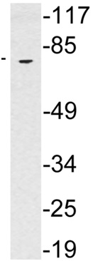 Anti-Serotonin transporter antibody (ab135846) at 1/500 dilution + extracts from Human brain tissue at 30 µg