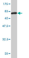 Western blot against tagged recombinant protein immunogen using ab57280 SERPINA10 antibody at 1ug/ml.