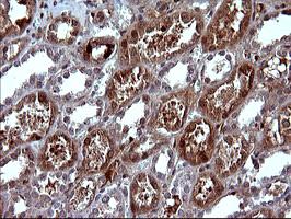 Immunohistochemical analysis of paraffin-embedded Human kidney tissue, labeling SerpinB3 using ab180396 at a 1/150 dilution.