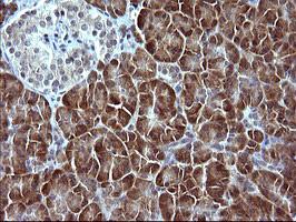 Immunohistochemical analysis of paraffin-embedded Human pancreas tissue, labeling SerpinB3 using ab180396 at a 1/150 dilution.