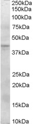 Anti-SERPINI2 antibody (ab36169) at 0.3 µg/ml + Human Pancreas lysate in RIPA buffer for 1 hour. at 35 µgdeveloped using the ECL technique