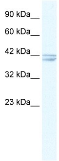 Anti-Nicotinic Acetylcholine Receptor alpha 7 antibody (ab10096) at 2.5 µg/ml + HepG2 cell lysate