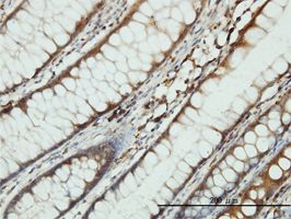 Seryl-tRNA synthetase antibody (ab55726) used in immunohistochemistry at 3ug/ml on formalin fixed and paraffin embedded human colon tissue.