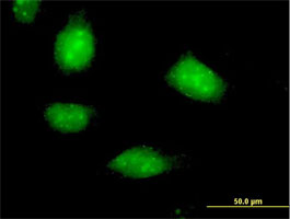 Immunofluorescence of ab67156 at 10 µg/ml on HeLa cells