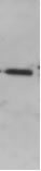 Western blot of 10 µg HEK 293 cell extracts with Anti- I2α (GLO150). The band corresponds to I2αPP2A (~ 39 kDa). Western blot of 10 µg HEK 293 cell extracts with Anti- I2a (GLO150). The band corresponds to I2aPP2A (~ 39 kDa).