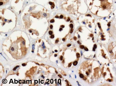 ab35252 (4µg/ml) staining SET in human kidney cortex using an automated system (DAKO Autostainer Plus). Using this protocol there is strong nuclear and cytoplasmic staining.Sections were rehydrated and antigen retrieved with the Dako 3-in-1 AR buffer citrate pH 6.0 in a DAKO PT Link. Slides were peroxidase blocked in 3% H2O2 in methanol for 10 minutes. They were then blocked with Dako Protein block for 10 minutes (containing casein 0.25% in PBS) then incubated with primary antibody for 20 minutes and detected with Dako Envision Flex amplification kit for 30 minutes. Colorimetric detection was completed with Diaminobenzidine for 5 minutes. Slides were counterstained with Haematoxylin and coverslipped under DePeX. Please note that, for manual staining, optimization of primary antibody concentration and incubation time is recommended. Signal amplification may be required.