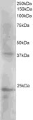 SET staining (2µg/ml) of Human Kidney extracts (RIPA buffer, 35µg total protein per lane). Primary incubated for 1 hour. Detected by western blot using chemiluminescence