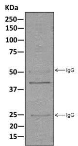 Western blot analysis on immunoprecipitation pellet from HeLa cell lysate labeling SET with ab176567 at 1/10 dilution.