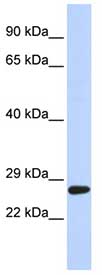 Anti-SETD4 antibody (ab85477) at 1 µg/ml (in 5% skim milk / PBS buffer) + 721_B cell lysate at 10 µgSecondaryHRP conjugated anti-Rabbit IgG at 1/50000 dilution