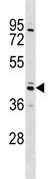 Anti-Sex Hormone Binding Globulin antibody (ab130379) at 1/100 dilution + 293 cell line lysates at 35 µg