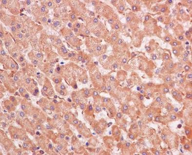 Immunohistochemical staining of paraffin embedded human liver with purified ab126617 at a working dilution of 1 in 300. The secondary antibody used is a HRP polymer for rabbit IgG. The sample is counter-stained with hematoxylin. Antigen retrieval was perfomed using Tris-EDTA buffer, pH 9.0.
