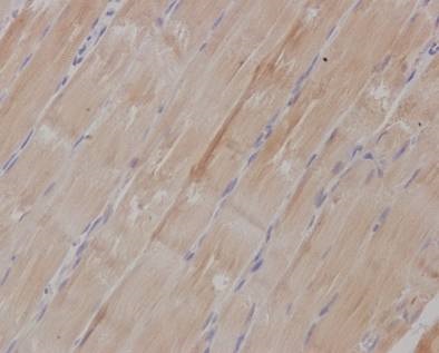Immunohistochemical staining of paraffin embedded rat muscle with purified ab126617 at a working dilution of 1 in 300. The secondary antibody used is a HRP polymer for rabbit IgG. The sample is counter-stained with hematoxylin. Antigen retrieval was perfomed using Tris-EDTA buffer, pH 9.0.