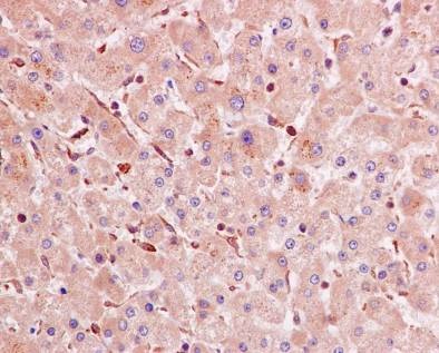 Immunohistochemical staining of paraffin embedded human liver with unpurified ab126617 at a working dilution of 1 in 15. The secondary antibody used is a HRP polymer for rabbit IgG. The sample is counter-stained with hematoxylin. Antigen retrieval was perfomed using Tris-EDTA buffer, pH 9.0.