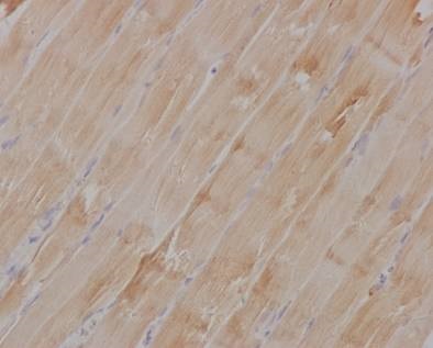 Immunohistochemical staining of paraffin embedded rat muscle with unpurified ab126617 at a working dilution of 1 in 15. The secondary antibody used is a HRP polymer for rabbit IgG. The sample is counter-stained with hematoxylin. Antigen retrieval was perfomed using Tris-EDTA buffer, pH 9.0.
