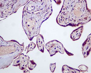 Immunohistochemical staining of Sex Hormone Binding Globulin in formalin-fixed, paraffin-embedded human placenta tissue with unpurified ab126617, at 1/50 dilution.