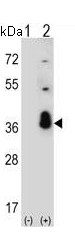 All lanes : Anti-SF2 antibody - C-terminal (ab135617) at 1/50 dilutionLane 1 : 293 cell lysate, non-transfected Lane 2 : 293 cell lysate, transiently transfected with the SF2 geneLysates/proteins at 2 µg per lane.developed using the ECL technique