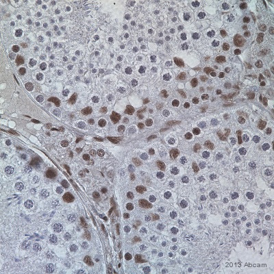 ab84680 staining NuMA in Marmoset (common) testis tissue sections by Immunohistochemistry (IHC-P - paraformaldehyde-fixed, paraffin-embedded sections). Tissue was fixed with Buoin's fixative, permeabilized in Triton X-100 (1/100 in PBS) and blocked with 25% serum for 30 minutes; antigen retrieval was by heat mediation in a citrate buffer, pH 6.0. Samples were incubated with primary antibody (1/100 in PBS + 0.5% BSA) for 17 hours at 4°C. A Biotin-conjugated Chicken anti-rabbit IgG polyclonal (1/100) was used as the secondary antibody.See Abreview