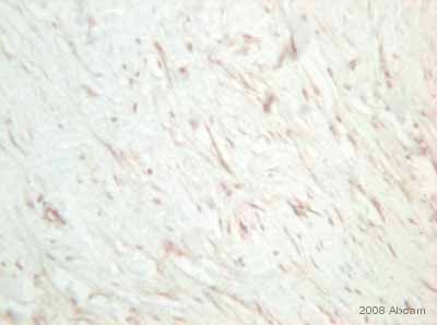 ab4193 staining human dermal hypertrophic scar tissue sections by IHC-P.  Sections were formaldehyde fixed and subjected to heat mediated antigen retrieval prior to blocking (with a commercial protein block) and incubating with the primary antibody (diluted 1/800) for 20 minutes.  A HRP-conjugated goat anti-rabbit antibody was used as the secondary.See Abreview