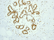ab109262, at 1/250 dilution, staining NuMA in paraffin-embedded Human breast tissue by Immunohistochemistry.