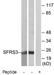 All lanes : Anti-SFRS3 antibody (ab73891) at 1/500 dilutionLane 1 : extracts from HeLa cellsLane 2 : extracts from Jurkat cellsLane 3 : extracts from Jurkat cells with immunizing peptide at 10 µgLysates/proteins at 30 µg per lane.