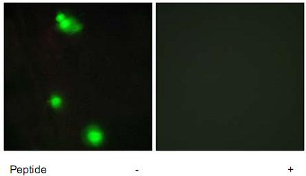 Left panel: immunofluorescence analysis of MCF7 cells, using 1/500-1/1000 ab73891; Right panel: same, after pre-incubation with the immunizing peptide.