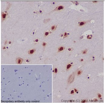 Immunohistochemical analysis of paraffin-embedded Human cerebral cortex tissue labeling SFRS3 with ab198291 at 1/500 dilution followed by Goat Anti-Rabbit IgG H&L (HRP) (ab97051) at 1/500 dilution. Nuclear and weakly cytoplasm staining on Human cerebral cortex tissue is observed. Counter stained with Hematoxylin.Negative control: Used PBS instead of primary ab.