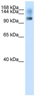 Anti-SFRS8 antibody (ab62382) at 2.5 µg/ml + 293T cell lysate at 10 µgSecondaryHRP conjugated anti-Rabbit IgG at 1/50000 dilution