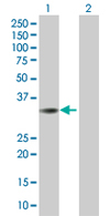 All lanes : Anti-SFXN2 antibody (ab67191) at 1/500 dilutionLane 1 : SFXN2 transfected 293T cell lysateLane 2 : Non transfected 293T cell lysateLysates/proteins at 25 µg/ml per lane.SecondaryGoat Anti-Mouse IgG (H&L)-HRP Conjugate at 1/2500 dilution
