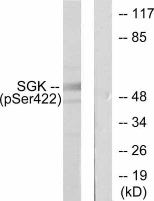All lanes : Anti-SGK1 (phospho S422) antibody (ab55281) at 1/500 dilutionLane 1 : extracts from HeLa cells treated with Insulin (0.01U/ml, 15mins).Lane 2 : extracts from HeLa cells treated with Insulin (0.01U/ml, 15mins), and incubated with the immunising phosphopeptide.