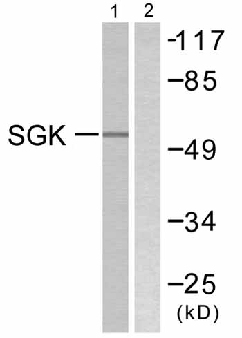 All lanes : Anti-SGK1 antibody (ab59337) at 1/500 dilutionLane 1 : 293 cells treated with heat shockLane 2 : 293 cells treated with heat shock with immunizing non-phosphopeptide