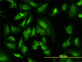 SGK1 antibody (ab55678) used in immunofluorescence at 10ug/ml on HeLa cells.