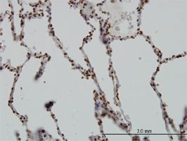 SGK1 antibody (ab55685) used in immunohistochemistry at 3ug/ml on formalin fixed and paraffin embedded human lung.