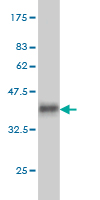 Western blot against tagged recombinant protein immunogen using ab55685 SGK1 antibody at 1ug/ml.