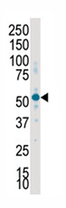 Anti-SGK2 antibody - Carboxyterminal end (ab71616) at 1/100 dilution + placenta lysate at 12.5 µgSecondaryHRP anti rabbit