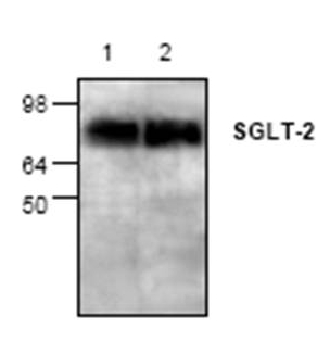 All lanes : Anti-SGLT2 antibody (ab37296) at 4 µg/mlLane 1 : Jurkat cell lysateLane 2 : Mouse small intestine tissue lysate