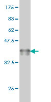 Western blot against tagged recombinant protein immunogen using ab57161 SH2B antibody at 1ug/ml.