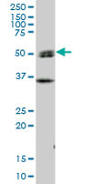 Anti-SH2D4A antibody (ab67249) at 1/500 dilution + human liver tissue lysate at 25 µg/mlSecondaryGoat Anti-Mouse IgG (H&L)-HRP Conjugate at 1/2500 dilution