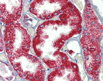 ab84297 at 5 µg/ml staining SH3BP2 in Human kidney tissue by Immunohistochemistry (Formalin/PFA-fixed paraffin-embedded sections).