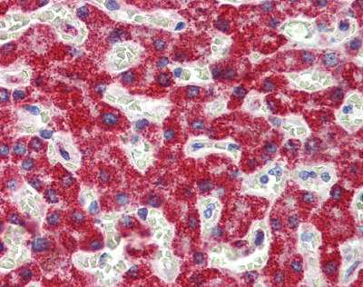 ab84297 at 5 µg/ml staining SH3BP2 in Human liver tissue by Immunohistochemistry (Formalin/PFA-fixed paraffin-embedded sections).