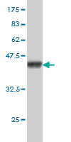Western blot against tagged recombinant protein immunogen using ab57005 SH3BP4 antibody at 1ug/ml.