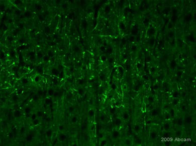 ab37500 staining NUMBL in rat brain tissue section by Immunohistochemistry (PFA perfusion fixed frozen sections). Tissue from 4% PFA perfused animals underwent overnight fixation in 4% paraformaldehyde, cryoprotected in 30% sucrose and cut using cryostat.The primary antibody was diluted, 1/1000 (PBS + 0.3% Triton X100) and incubated with sample for 18 hours at 20°C. An Alexa Fluor® 488 conjugated goat polyclonal to rabbit IgG was used undiluted as secondary.