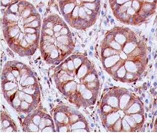 Immunohistochemical analysis of paraffin-embedded Human colon tissue labeling SH3PX1 with ab181856 at 1/250 dilution, followed by prediluted HRP Polymer for Rabbit IgG. Counter stained with Hematoxylin.