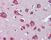 ab110851 at 5&microg/ml staining Nicotinic Acetylcholine Receptor alpha 7 in Formalin-fixed, Paraffin-embedded Human Brain cortex tissue by Immunohistochemistry followed by biotinylated secondary antibody, alkaline phosphatase-streptavidin and chromogen.