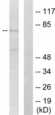 All lanes : Anti-SHC (phospho Y427) antibody (ab51170) at 1/500 dilutionLane 1 : Hela cell extract treated with Calyculin A (50ng/ml, 15min) with immunising peptideLane 2 : Hela cell extract treated with Calyculin A (50ng/ml, 15min)