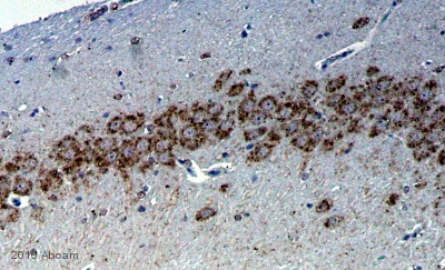 ab32096 staining Nicotinic Acetylcholine Receptor alpha 7 in Rat hippocampus tissue by Immunohistochemistry (Formalin/PFA-fixed paraffin embedded sections). Sections were PFA-fixed, and subjected to antigen retrieval by autoclave prior to blocking with 8% milk for 30 minutes at 37°C. The primary antibody was diluted 1/50 with DAKO antibody diluent and incubated with the sample for 18 hours at 4°C. An HRP-conjugated Goat anti-Rat polyclonal antibody was used undiluted as the secondary antibody.See Abreview