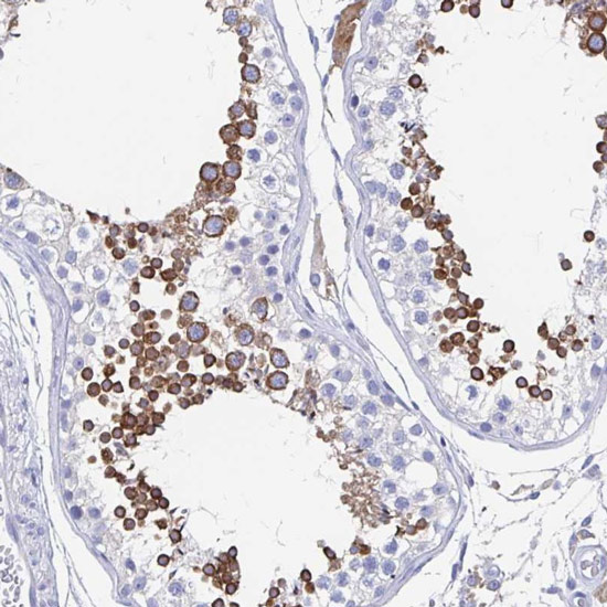 Immunohistochemistry (Formalin/PFA-fixed paraffin-embedded sections) analysis of human testis tissue labelling SHCBP1L with ab122310. Staining shows strong cytoplasmic positivity in cells in seminiferous ducts.
