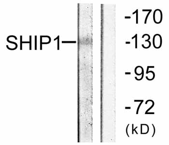 All lanes : Anti-SHIP antibody (ab59338) at 1/500 dilutionLane 1 : Mouse brain cells minus immunising peptideLane 2 : Mouse brain cells plus immunising peptide