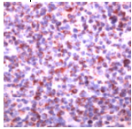 Ab41836 staining human SHIP in human tonsil by immunohistochemistry at 1/100 dilution using formalin fixed, paraffin embedded tissue.