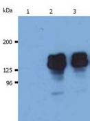 Lane 1 :  Isotype mouse IgG1 controlLanes 2 - 3 :  Anti-SHIP antibody [SHIP-01] (ab65807)Lane 1 : whole cell lysate of THP-1 human acute monocytic leukemia cell line.Lane 2 : whole cell lysate of THP-1 human acute monocytic leukemia cell line.Lane 3 : whole cell lysate of THP-1 human acute monocytic leukemia cell line.